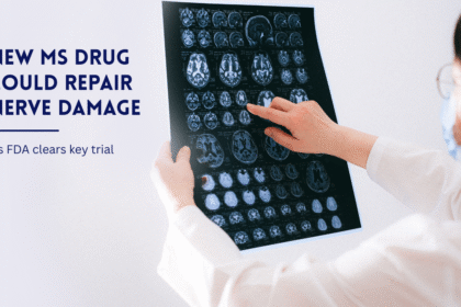 Doctor reviewing brain MRI for MS research.