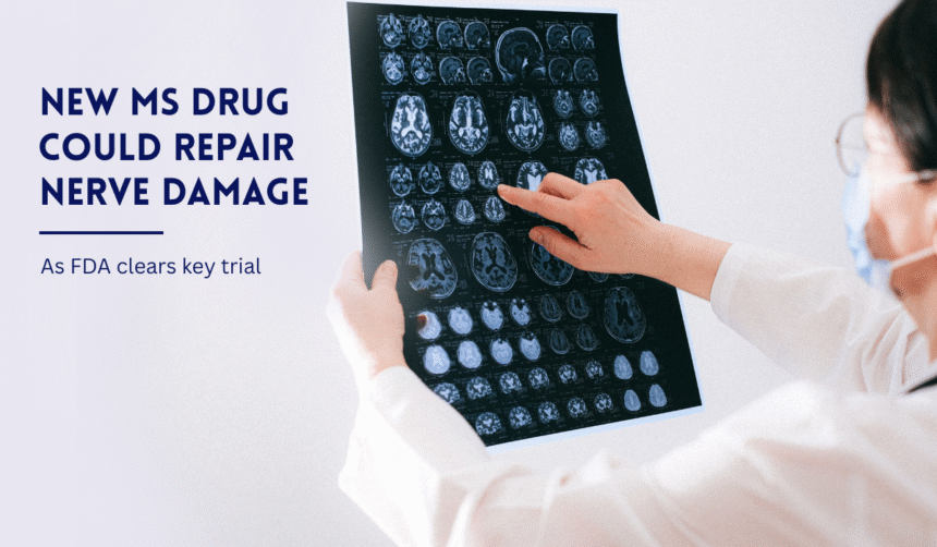 Doctor reviewing brain MRI for MS research.